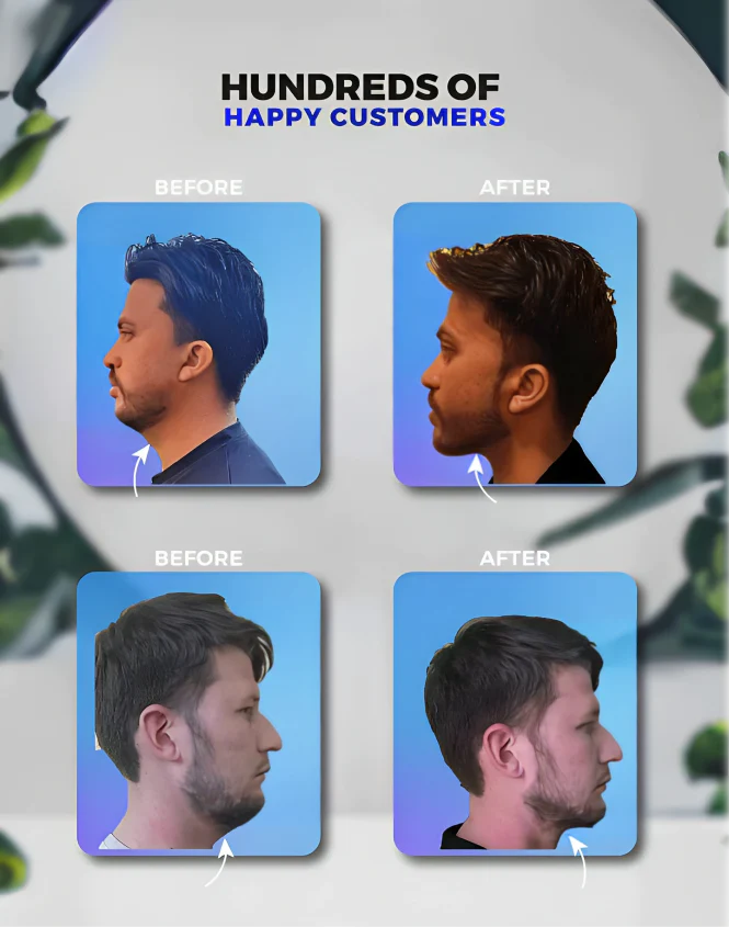 Jaw Enhance - Ultimate Facial Exerciser
